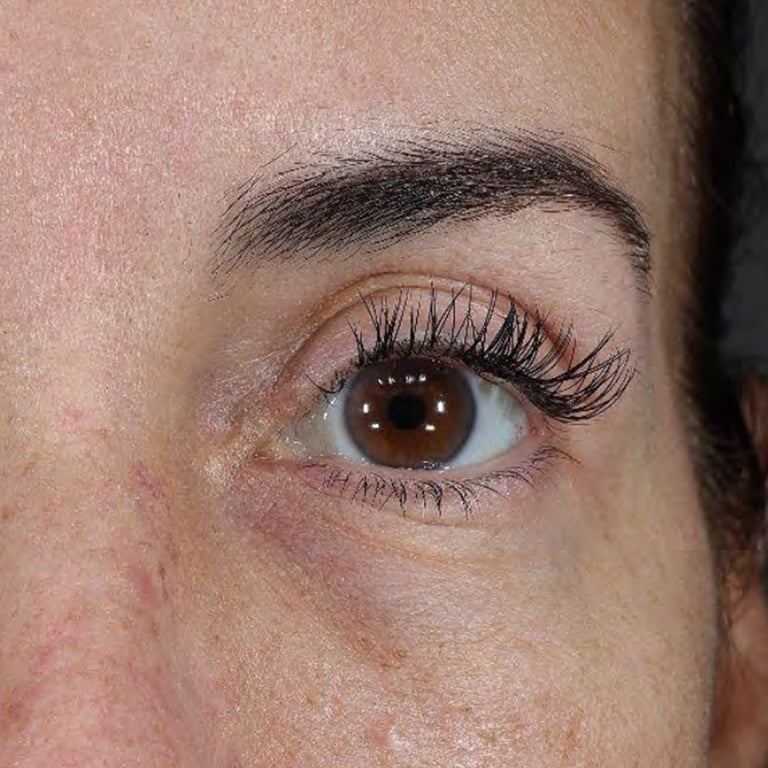 Same under-eye area with visibly brighter skin after 4 weeks of Wide Awake Brightening Eye Cream